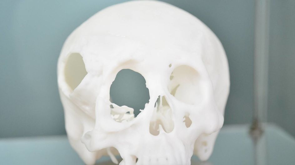 Meditool liefert 3D gedruckte Lösungen für den Orthopädie-Implantat-Markt