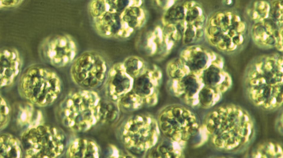 Drops of goodness: algae, as seen under the microscope, are the source of the omega-3 fatty acids EPA and DHA.